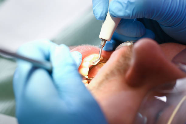 Best Emergency Treatment for Oral Infections in Keyes, CA